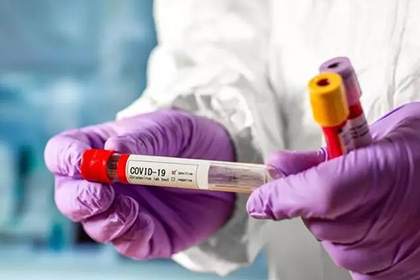 Где сделать тест на коронавирус для работников московских предприятий? 
